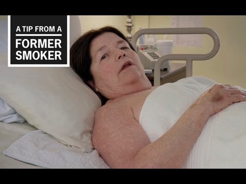 Smoking contributes to one in five strokes in the United States. In this TV ad for CDC's Tips From Former Smokers campaign, Suzy talks about losing her independence after smoking caused her to have a stroke.
