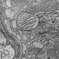 Cells were fixed, stained, dehydrated and embedded in plastic in order to be cut thinly for imaging in the transmission electron microscope. This image of a thin section of a single cell shows distinct cellular compartments and structures within them. Credit: Tina Carvalho, University of Hawaii.