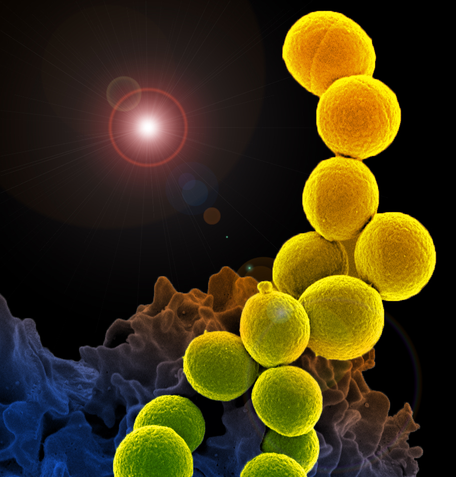 colorized scanning electron micrograph of a white blood cell being infected by an antibiotic resistant strain of Staphylococcus aureus bacteria