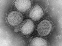 Imagen del virus de la influenza H1N1
