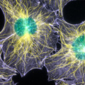 Fluorescence speckle microscopy (FSM) generated this image, which shows the intricate network of microtubule (yellow) and actin filament (purple) fibers that builds a cell's structure. The nuclei appear in greenish-blue color. In FSM, only a small fraction of the protein is labeled, significantly reducing out-of-focus fluorescence and greatly improving visibility of fluorescently labeled structures and their dynamics in thick regions of living cells. Credit: Clare Waterman-Storer, NIH.