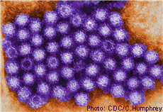 Micrograph of norovirus particles