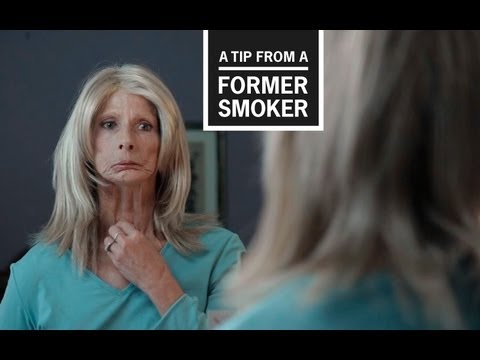 Smoking causes cancer. In this TV ad for CDC's Tips From Former Smokers campaign, Terrie talks about how she gets ready for the day after the effects of treatments for throat cancer caused her to lose her teeth and hair, and to have a laryngecotomy.