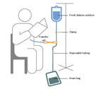 A schematic of a person receiving continuous ambulatory peritoneal dialysis exchange while reading