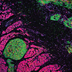 Confocal micrograph of green and pink patches of cells.