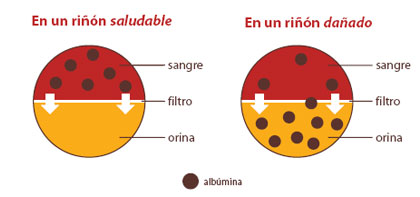 Gráfica que muestra la diferencia entre un riñón