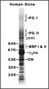 Diagram: Original gel showing PGI and PGII