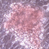 Image of a colony of red blood cells.