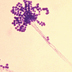 Microscope image of a fungus.