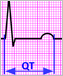 Illustration of an EKG graph showing the QT interval.