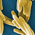 Electron micrograph of several rod-shaped bacteria.