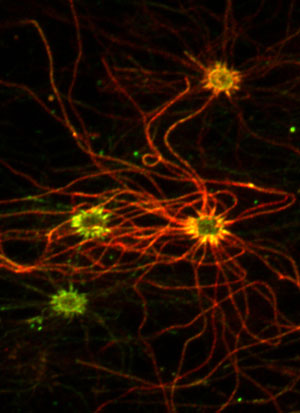 Olfactory sensory neurons express green and red fluorescently tagged proteins after being infected by a common cold virus.