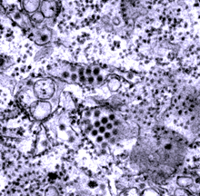 Transmission electron micrograph of dengue virus particles in tissue.