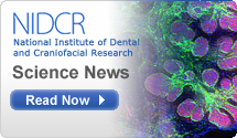 NIDCR: National Institute of Dental and Craniofacial Research-Science News