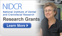 NIDCR: National Institute of Dental and Craniofacial Research-Research Grants