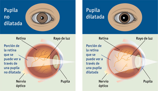 dilatación de pupilas