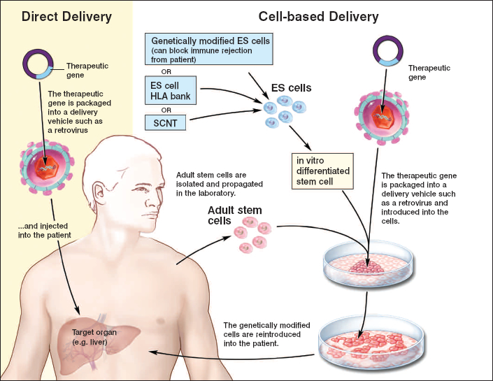 Figure 4.3. Strategies for Delivering Therapeutic Transgenes into Patients. This figure illustrates the steps involved in direct delivery of a therapeutic transgene (left panel, in yellow) and for cell-based delivery of a therapeutic transgene (right panel). In direct delivery, the therapeutic gene is packaged into a delivery vehicle, such as a retrovirus, and injected into the patient.  For cell-based delivery, the therapeutic genes are again packaged into a delivery vehicle, such as a retrovirus, but are introduced into stem cells in culture.  The stem cells can be derived from embryonic stem cells that are differentiated into a specific tissue type, or from adult stem cells isolated from the patient.  The genetically modified cells are then grown in culture and introduced into the patient.