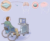 Brain-computer interfaces: Has science fiction become reality?