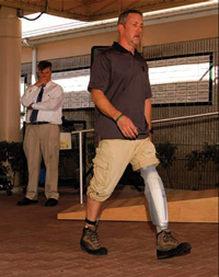 Evidence-based Prosthetics is Focus of New Workshops