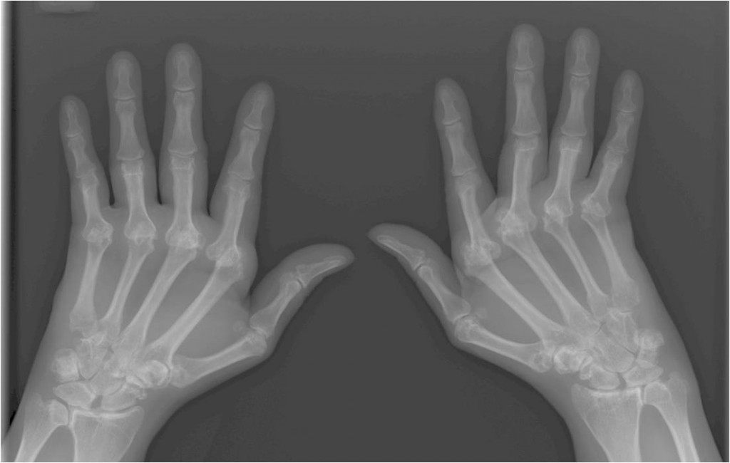 x-ray image of hands
