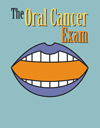 The Oral Cancer Exam