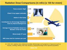 Radiation dose comparison