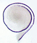 Gene expression in the organ of Corti.