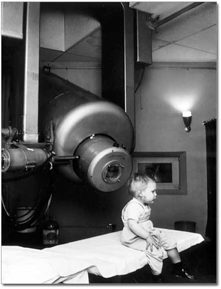 retinoblastoma in children - historic photo shows a patient, a small boy, being treated with the linear accelerator (radiation therapy) for retinoblastoma.