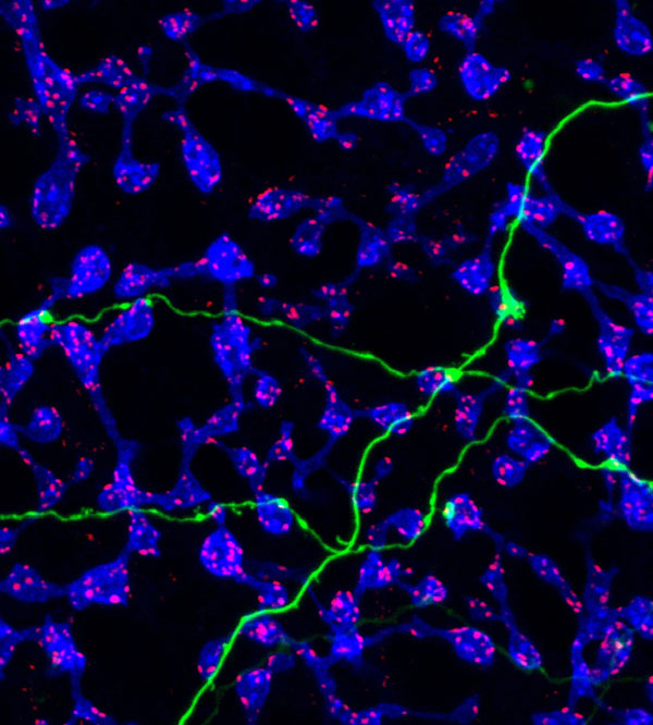 view of light-sensitive retina tissue found in the back of the eye