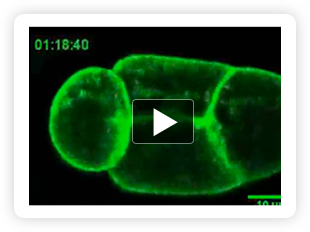 Glow Worm: Green Fluorescent Proteins light up C. elegans