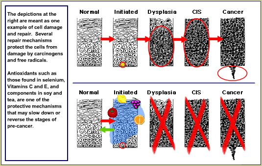 These depictions are meant as one example of cell damage and repair.  Several repair mechanisms protect the cells from damage by carcinogens and free radicals. Antioxidants such as those found in selenium, Vitamins C and E, and components in soy and tea, are one of the protective mechanisms that may slow down or reverse the stages of pre-cancer.