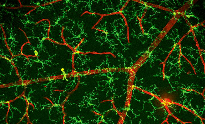 tissue from the light-sensitive retina in the back of the eye