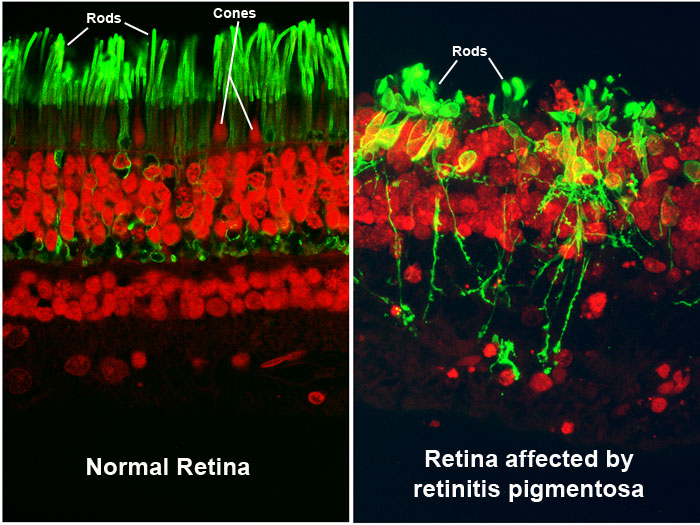 Retina Tissue