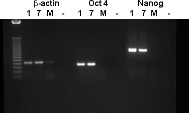 WA01, WA07 PCR for beta-actin, Oct-4, and Nanog mRNA