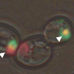 Prions (red) and huntingtin protein (green) within cells' aggresomes.