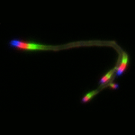 Cell wall of actively growing bacteria with multicolored probes.
