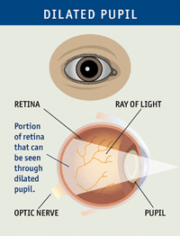 dilated pupil image