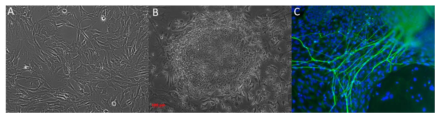 three photos of (from left to right) human dermal fibroblast, iPS colony derived from human fibroblast and neuron cells
