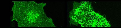 Click here to see enlarge photo of Fas/CD95 receptor clustering on living cells, and caption.