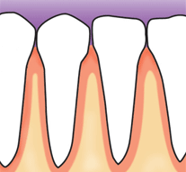 Healthy gums and bone anchor teeth firmly in place.