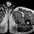 thumbnail image of Bartonella henselae/Bacillary angiomatosis: soft-tissue mass in the right thigh