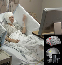 Brain study participant (left) and micro-electrocorticography imagery (right)