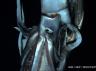 The elusive giant squid