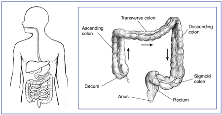 Drawing of the lower gastrointestinal tract inside the outline of a man’s torso with an inset.