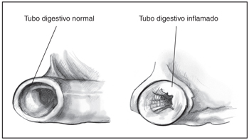 Ilustración de dos cortes transversales del tubo digestivo.