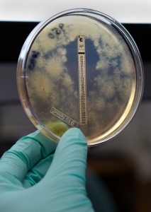 Fungal sample being held up for examination