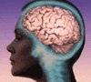What Is Alzheimer's Disease? - opens in new window