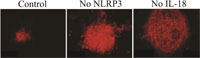 NLRP3 inflammasome activity may protect eye tissue during wet AMD.