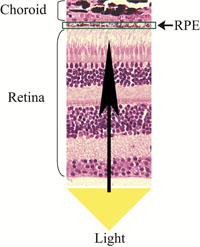 AMD destroys the light-sensing eye tissue unit.