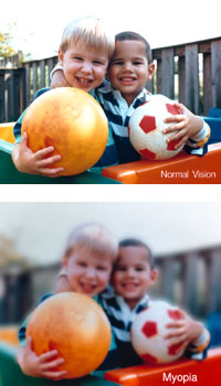 Top: Normal Vision. Bottom: A scene as it might be viewed by a person with myopia (nearsightedness).